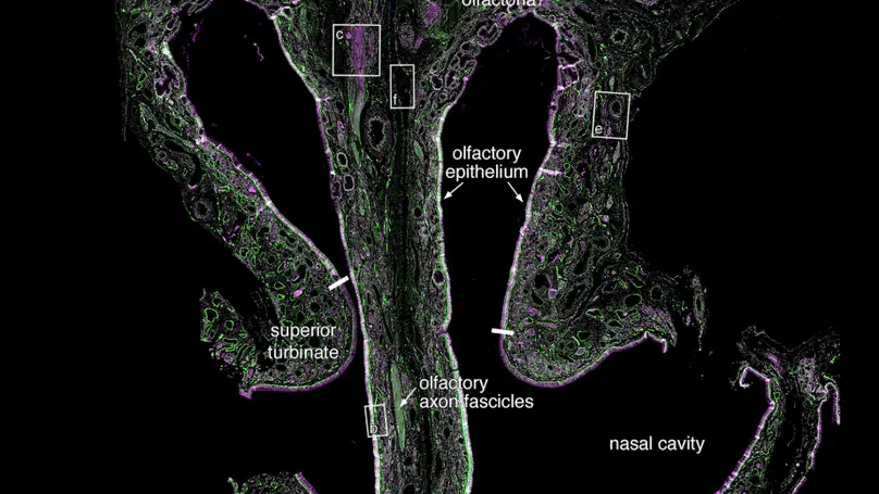 3D Reconstruction of Human Olfactory Projection
